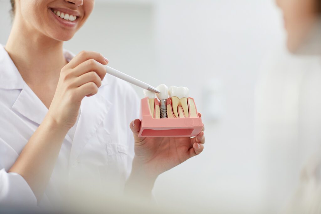 Dental Implants in San Antonio, TX