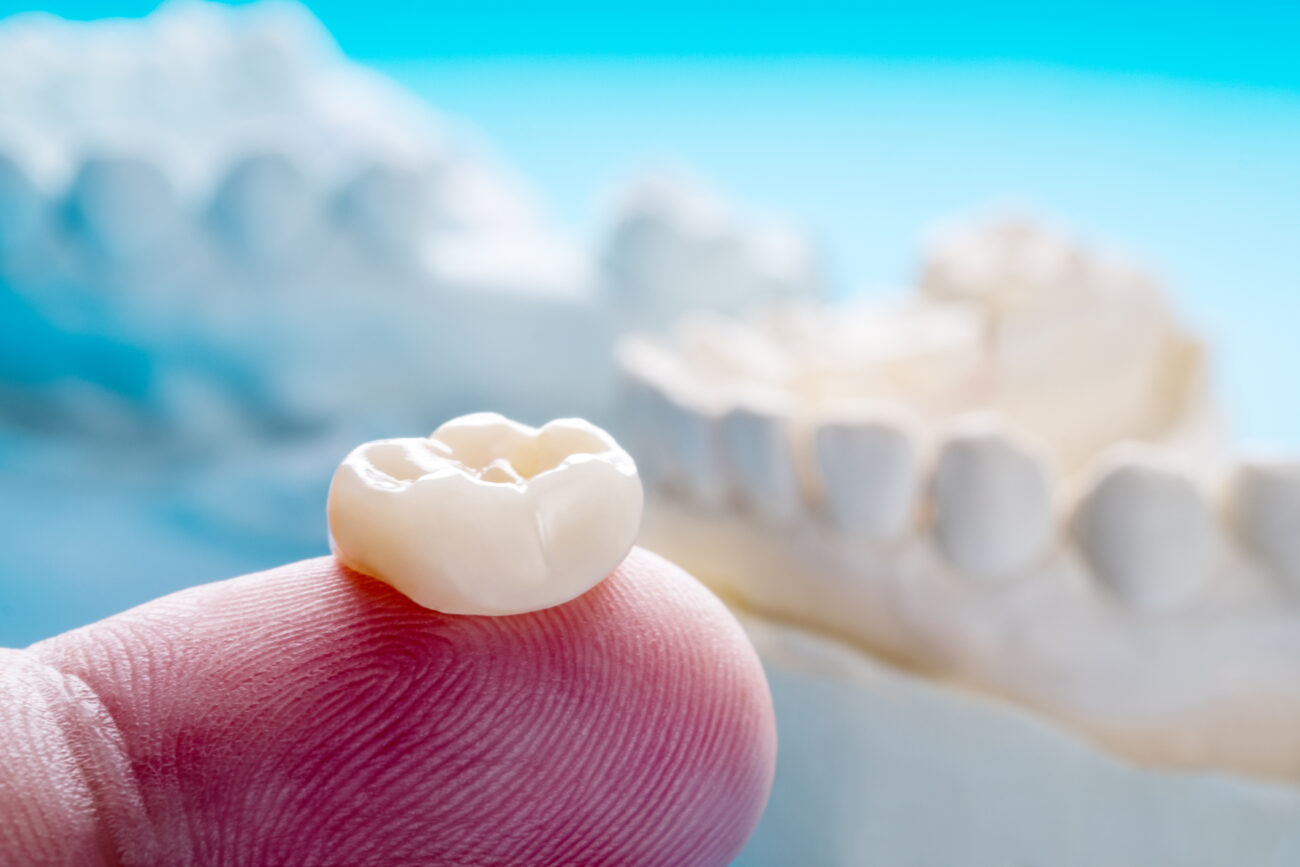 dental-crown-treatment-scaled.jpg
