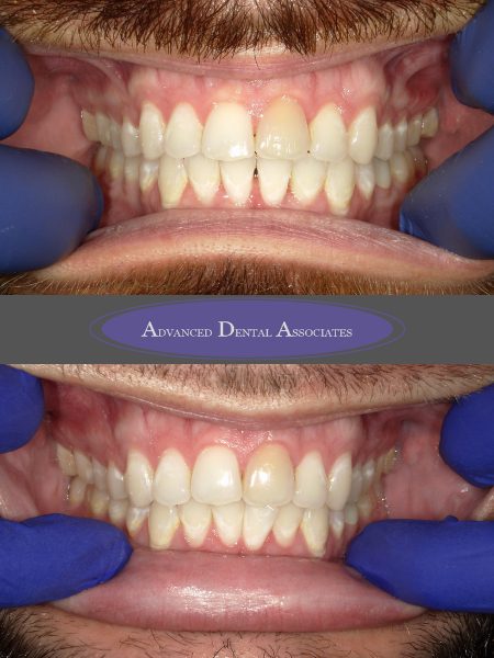 before dentistry at Advanced Dental Associates