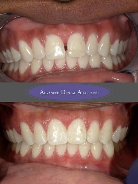 before dentistry at Advanced Dental Associates